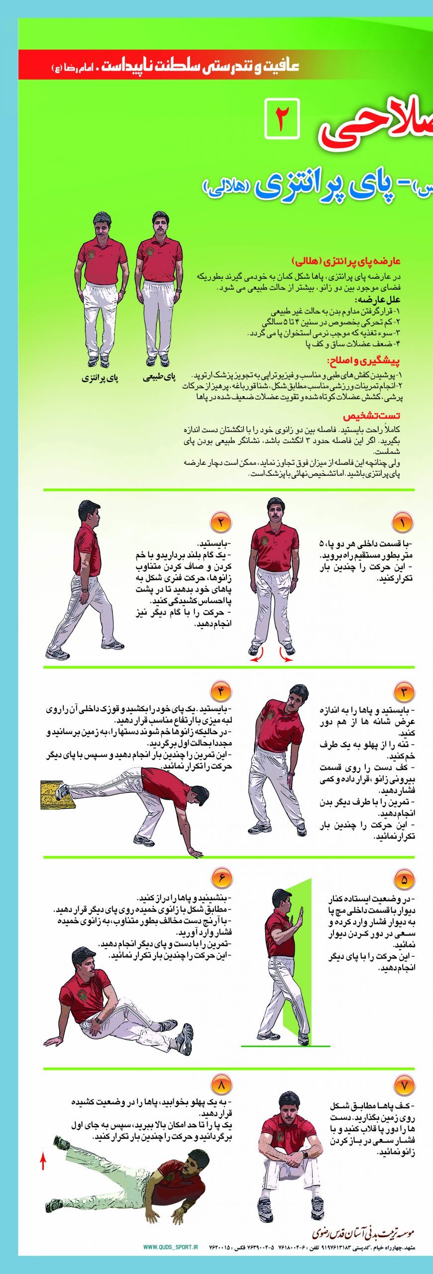 تصویر روش علمی تمرین های درمان پای پرانتزی در مشهد را شرح می دهد .