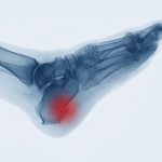 علاج طبیعی تقویم العظام فی ایران مشهد