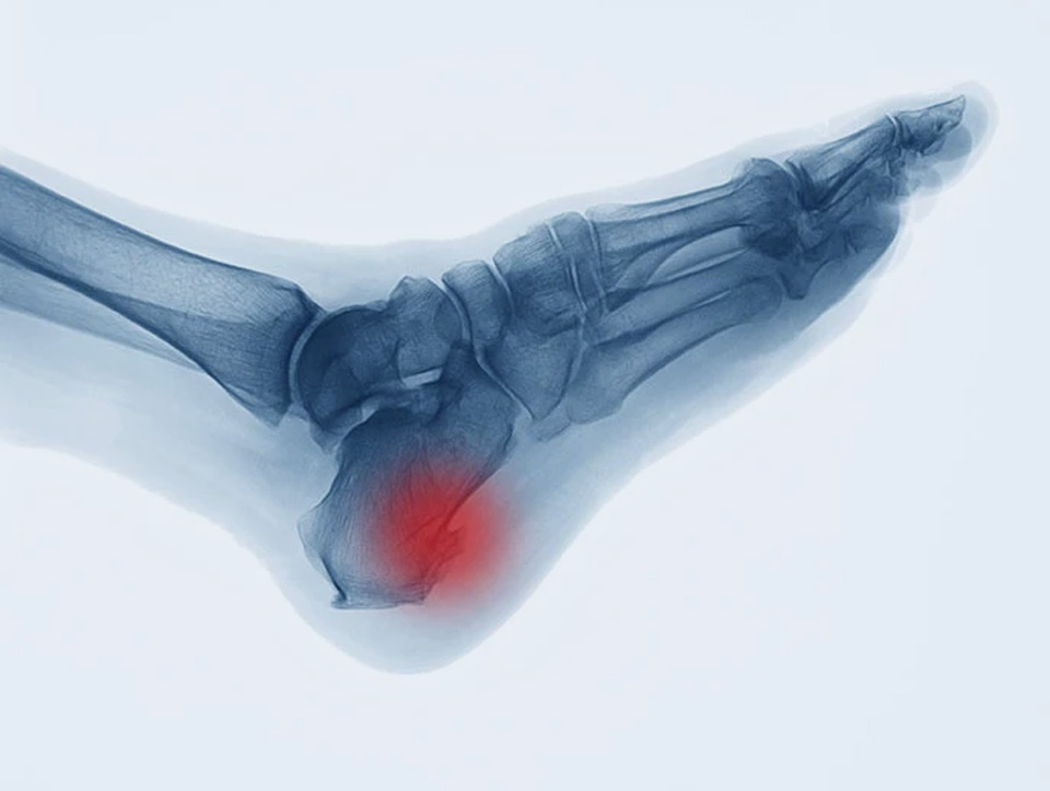 علاج طبیعی تقویم العظام فی ایران مشهد